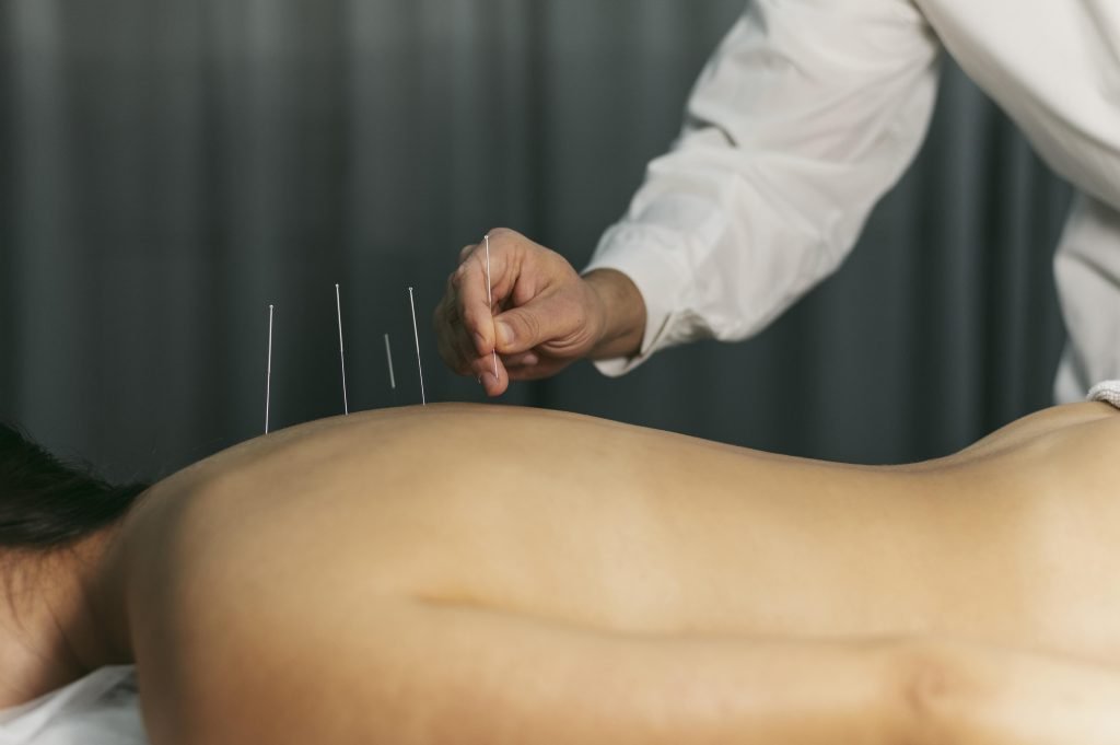 Acupuncturist in Leeuwarden